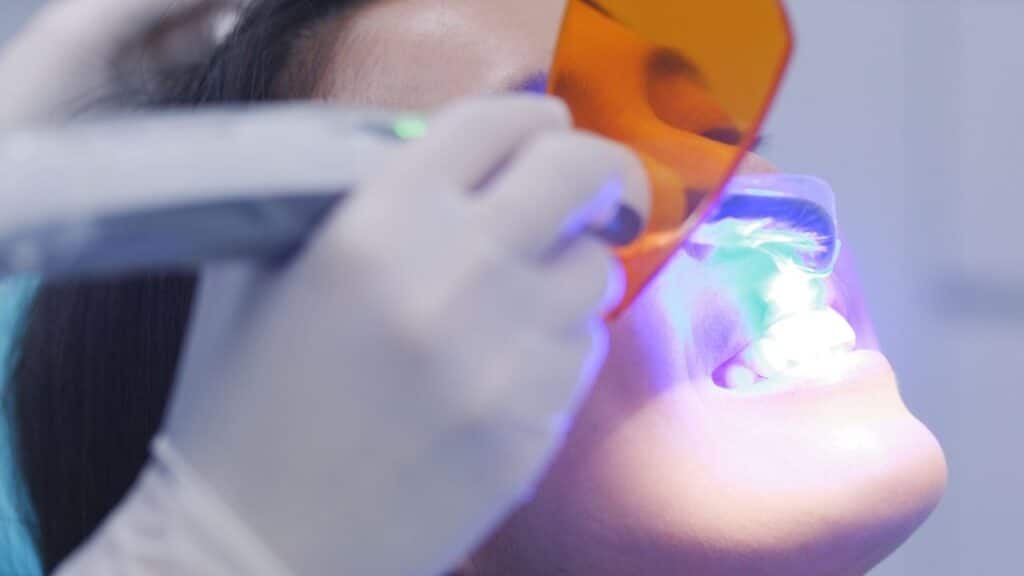 Composite bonding brighton