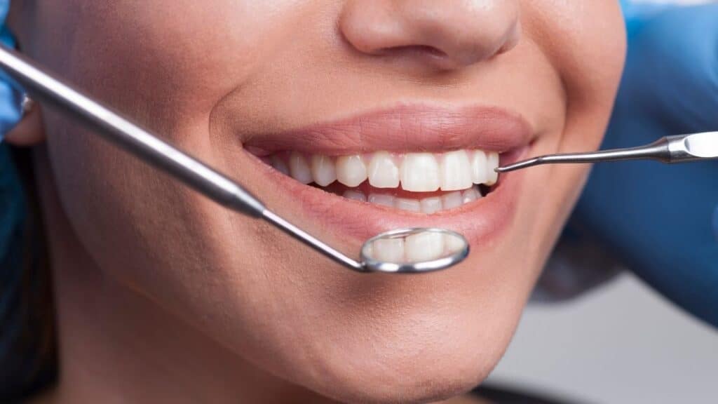 Composite bonding brighton