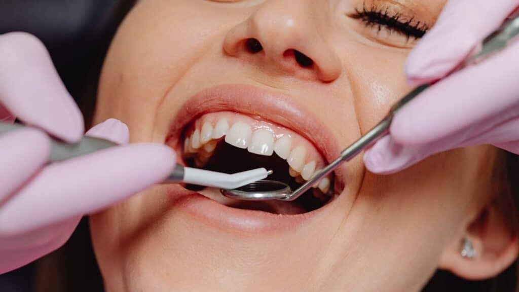 tooth extraction in brighton