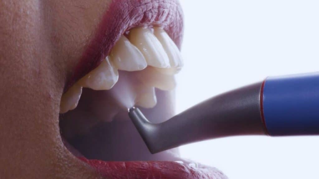 stain removal in brighton